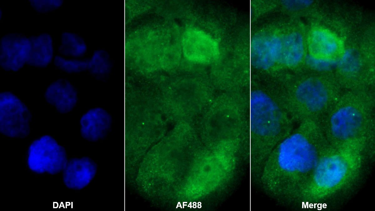 Monoclonal Antibody to Interleukin 1 Receptor Antagonist (IL1RA)