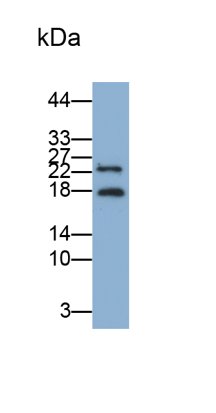 Monoclonal Antibody to Interleukin 1 Receptor Antagonist (IL1RA)