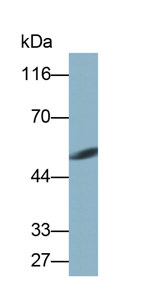 Monoclonal Antibody to Matrix Metalloproteinase 11 (MMP11)