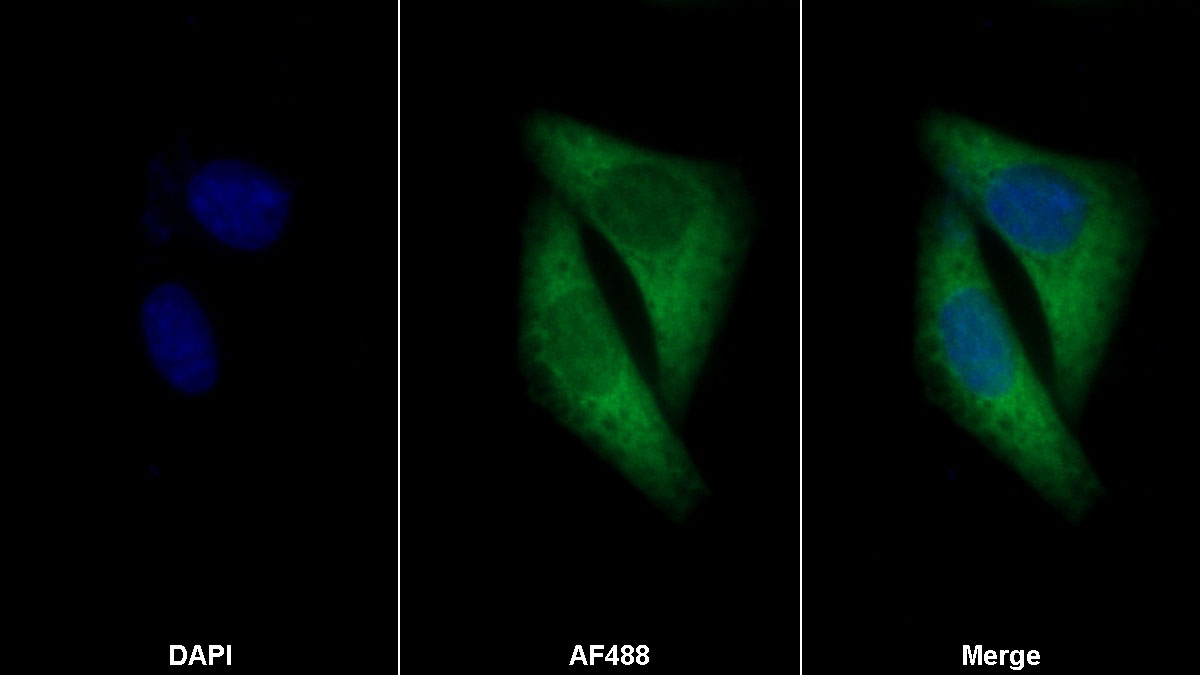 Monoclonal Antibody to Cyclophilin B (CYPB)