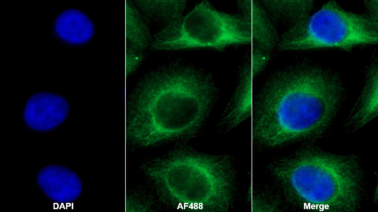 Monoclonal Antibody to Anti-Mullerian Hormone (AMH)