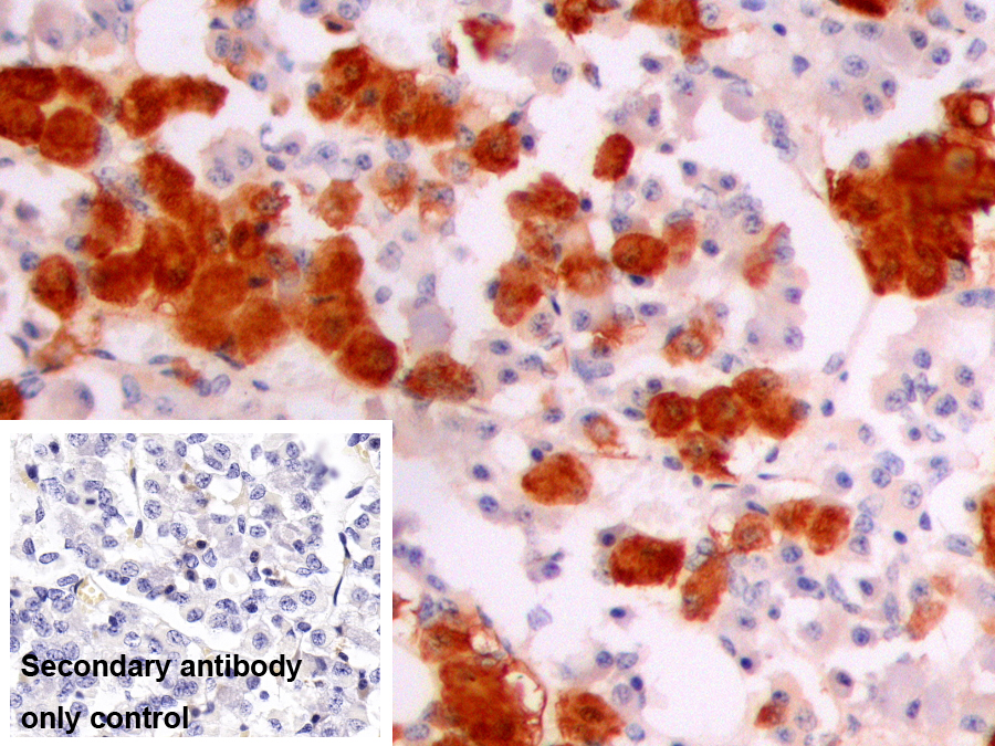 Monoclonal Antibody to Alpha-Melanocyte Stimulating Hormone (aMSH)