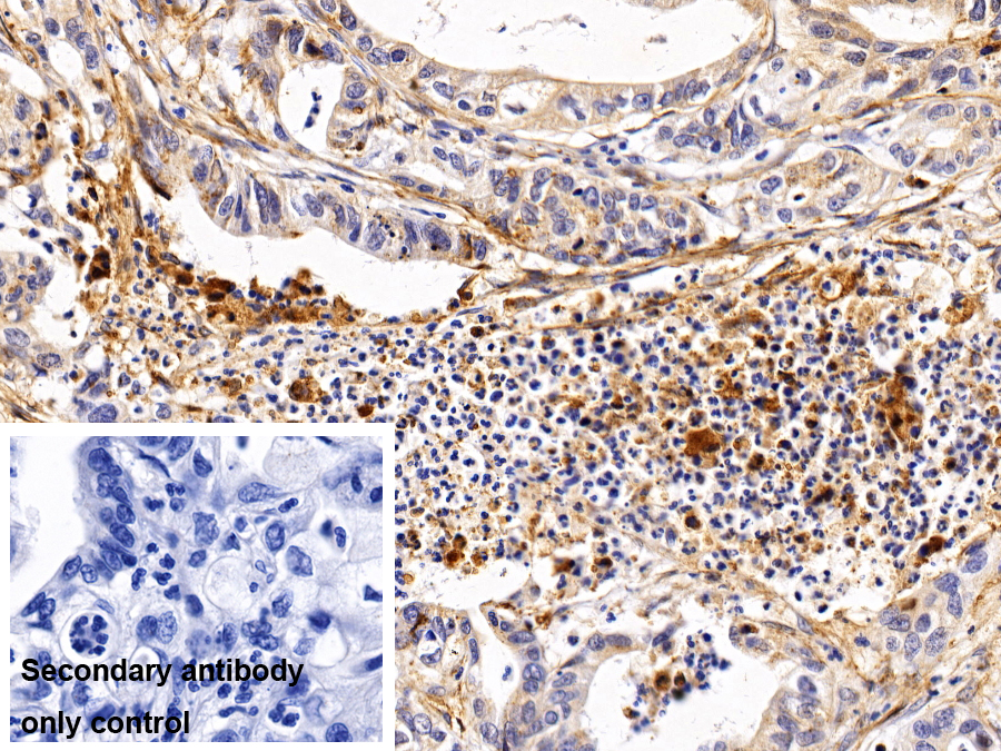 Monoclonal Antibody to Annexin V (ANXA5)