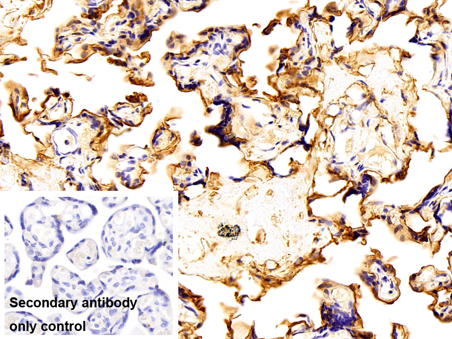 Monoclonal Antibody to Annexin V (ANXA5)