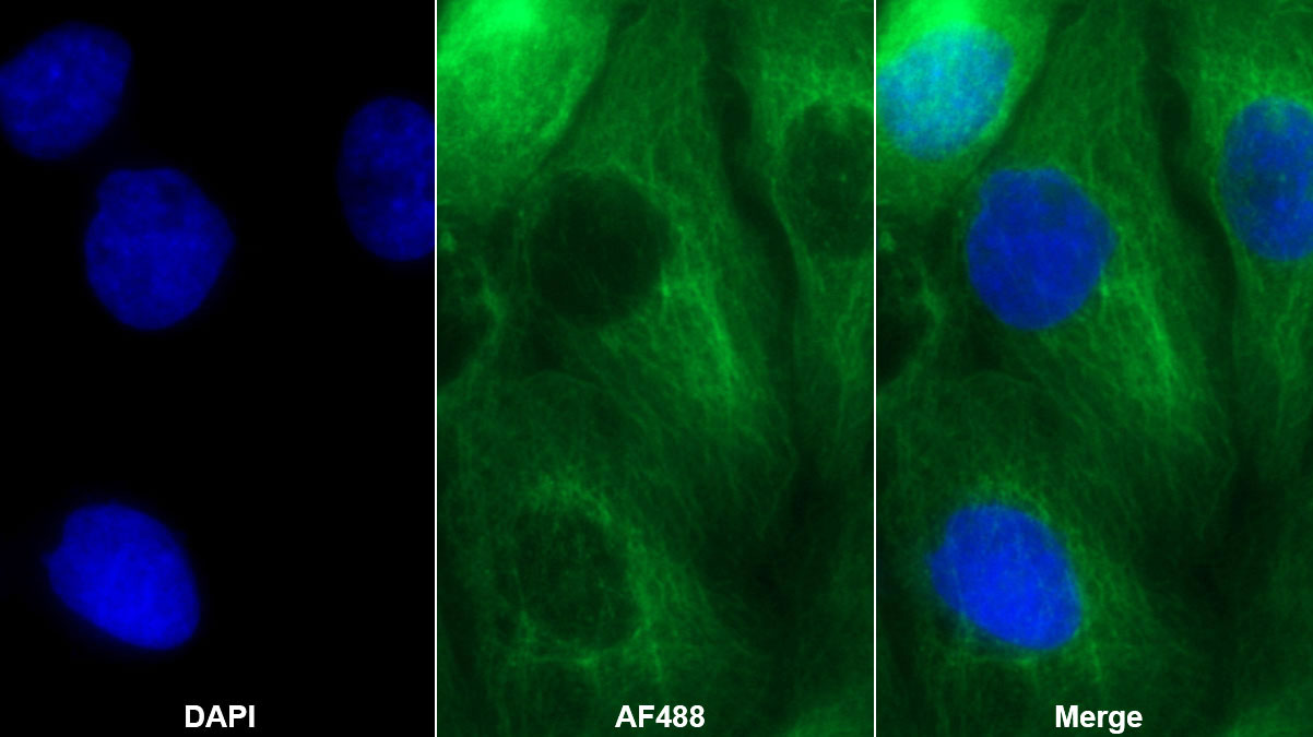 Monoclonal Antibody to Beta-2-Microglobulin (b2M)