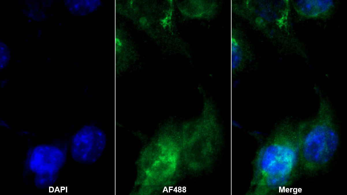 Monoclonal Antibody to Beta-2-Microglobulin (b2M)