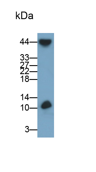 Monoclonal Antibody to Beta-2-Microglobulin (b2M)