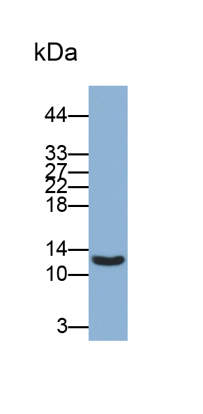 Monoclonal Antibody to Beta-2-Microglobulin (b2M)