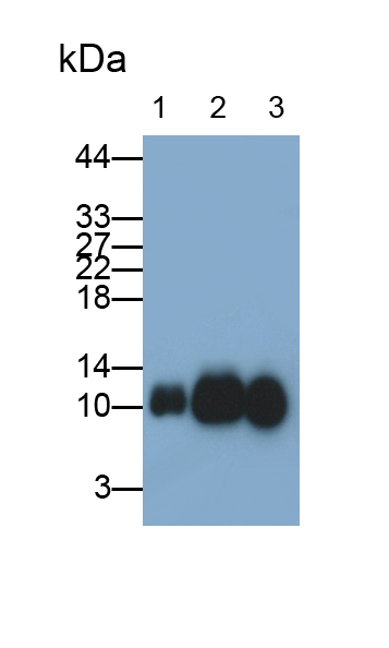 Monoclonal Antibody to Beta-2-Microglobulin (b2M)