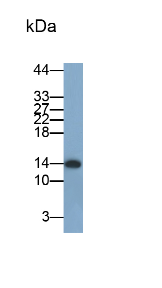 Monoclonal Antibody to Beta-2-Microglobulin (b2M)