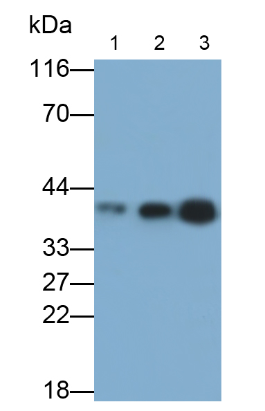 Monoclonal Antibody to Cathepsin K (CTSK)
