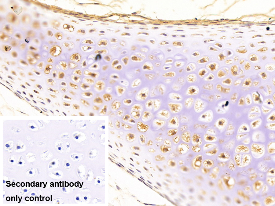 Monoclonal Antibody to Cathepsin K (CTSK)