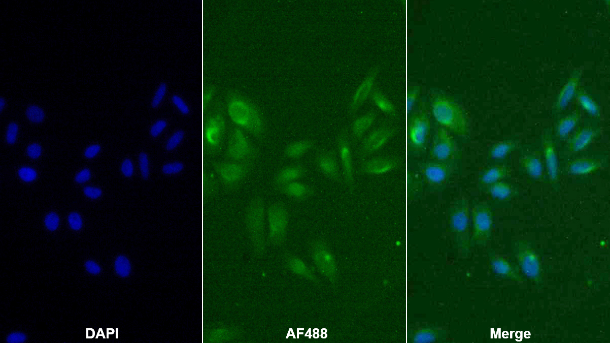 Monoclonal Antibody to Cathepsin K (CTSK)