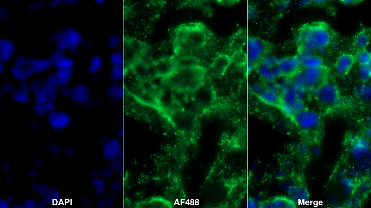 Monoclonal Antibody to Cathepsin K (CTSK)