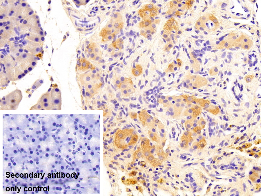 Monoclonal Antibody to Neuronal Pentraxin II (NPTX2)