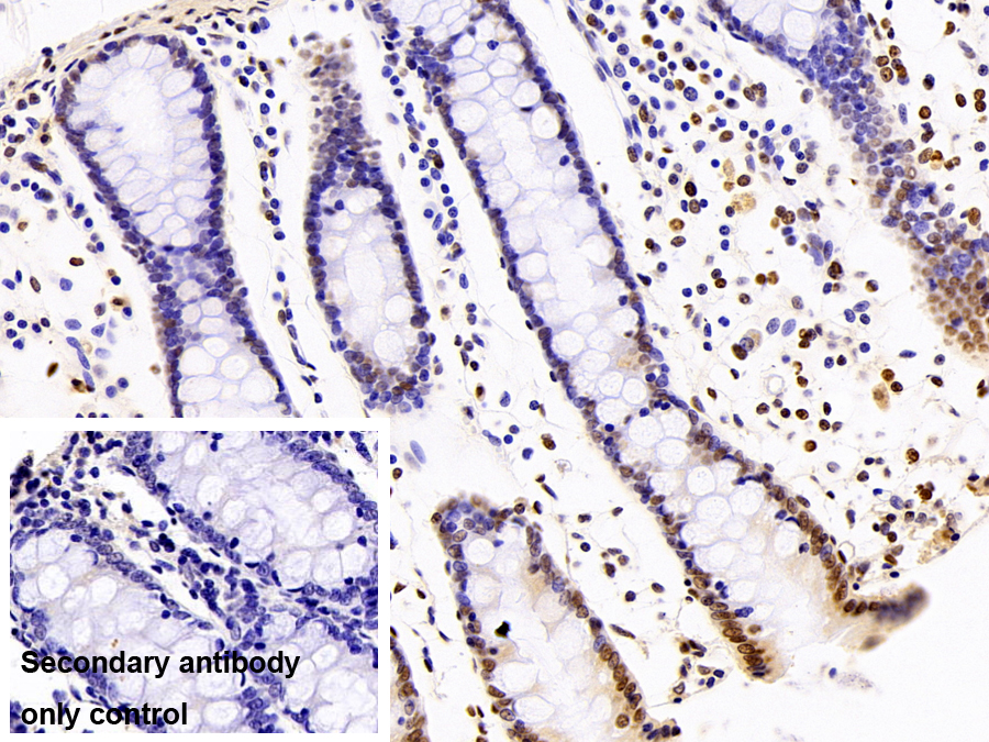 Monoclonal Antibody to Heterogeneous Nuclear Ribonucleoprotein A2/B1 (HNRPA2B1)