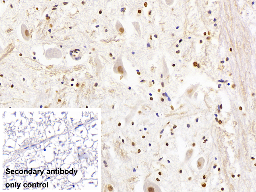 Monoclonal Antibody to Heterogeneous Nuclear Ribonucleoprotein A2/B1 (HNRPA2B1)