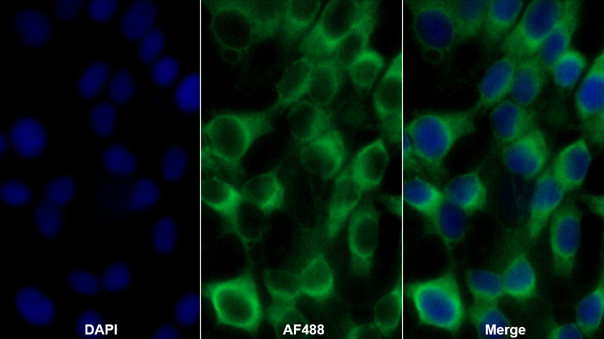 Monoclonal Antibody to Cocaine And Amphetamine Regulated Transcript (CART)