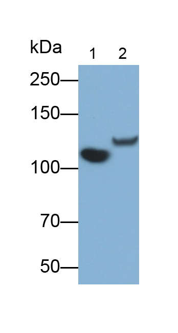 Monoclonal Antibody to Complement Component 5a (C5a)