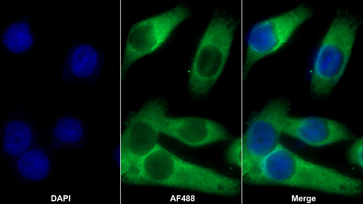 Monoclonal Antibody to Complement Component 5a (C5a)