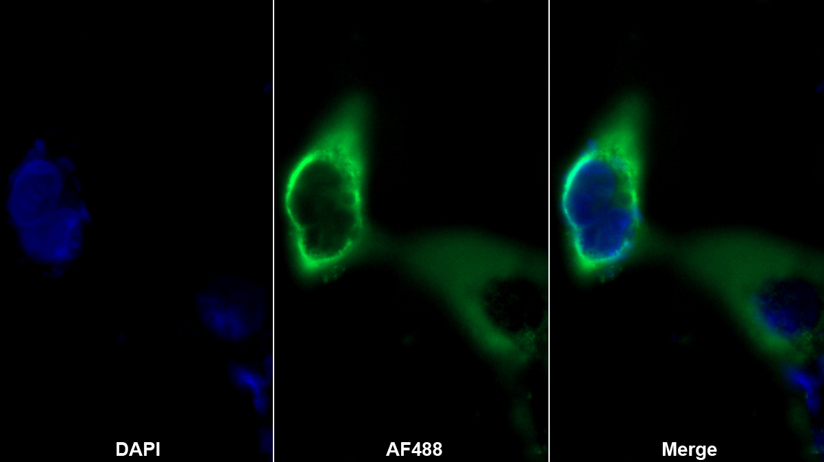 Monoclonal Antibody to Complement Component 5a (C5a)