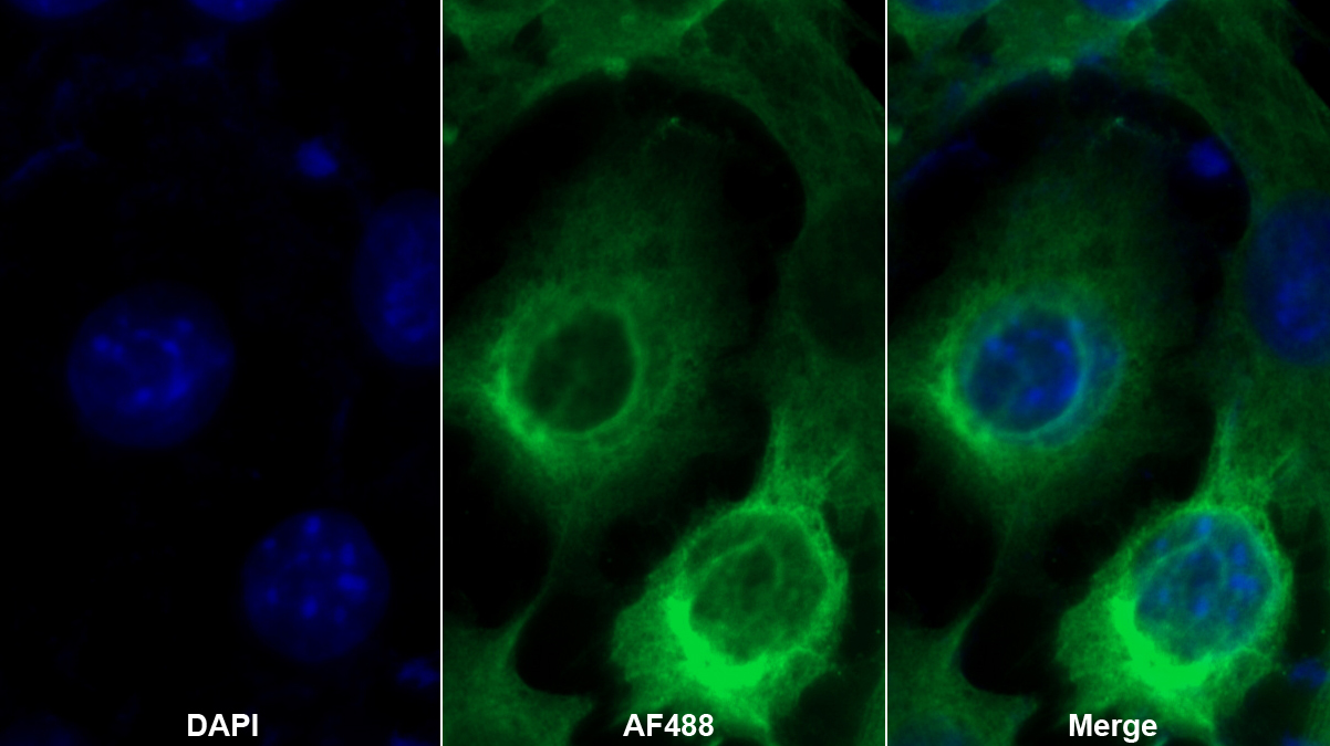 Monoclonal Antibody to Complement Component 5a (C5a)