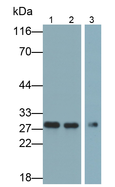 Monoclonal Antibody to Tissue Factor Pathway Inhibitor (TFPI)