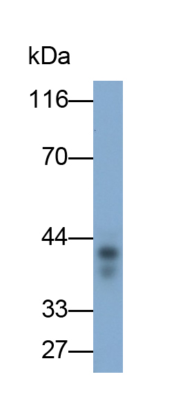 Monoclonal Antibody to Tissue Factor Pathway Inhibitor (TFPI)