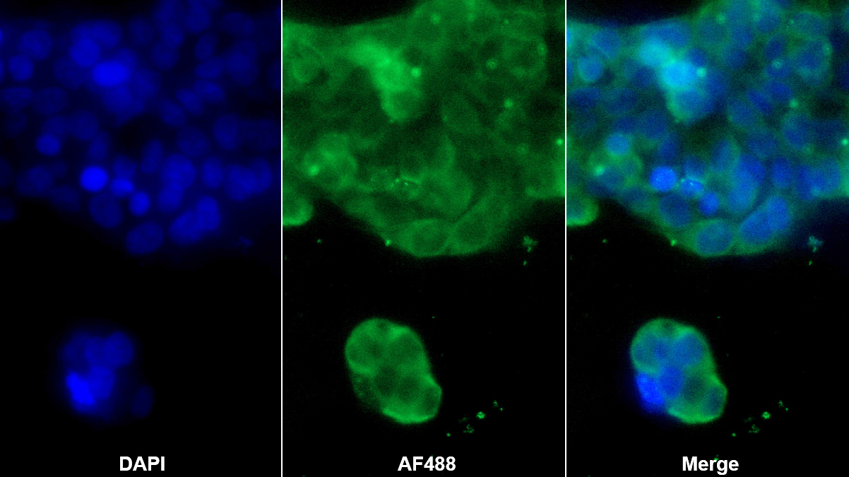 Monoclonal Antibody to Sex Hormone Binding Globulin (SHBG)
