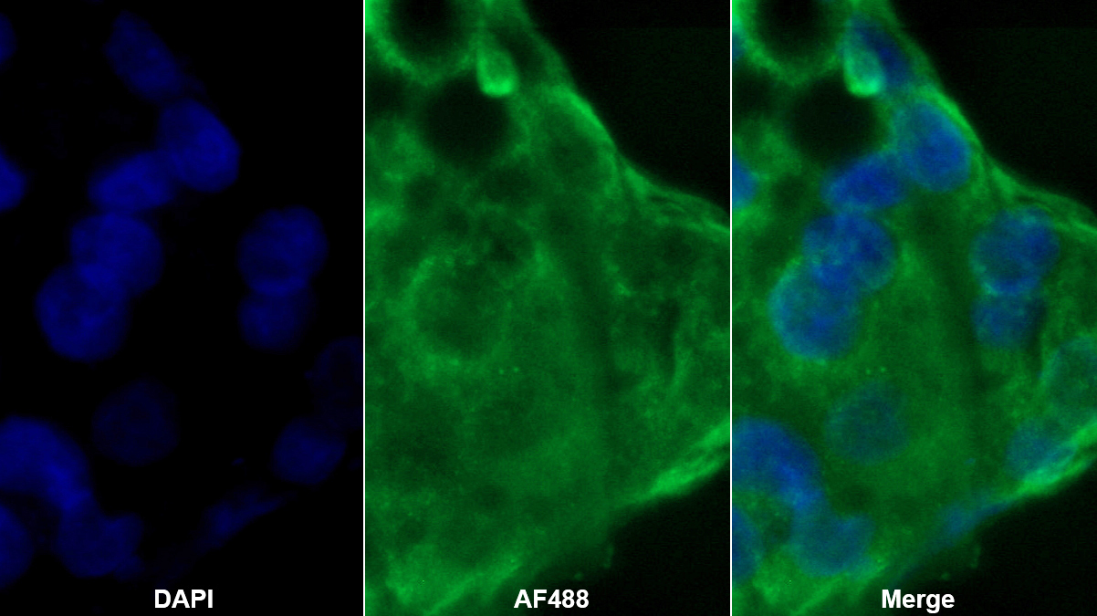 Monoclonal Antibody to Sex Hormone Binding Globulin (SHBG)
