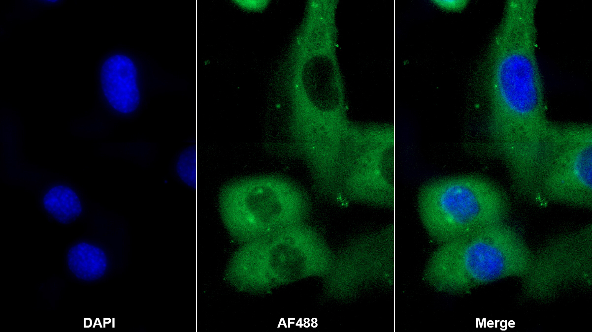 Monoclonal Antibody to Sex Hormone Binding Globulin (SHBG)