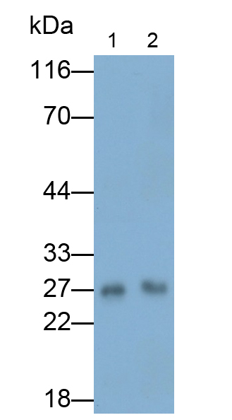 Monoclonal Antibody to Myelin Oligodendrocyte Glycoprotein (MOG)