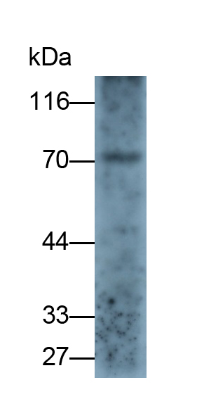 Monoclonal Antibody to Protein Kinase C Delta (PKCd)