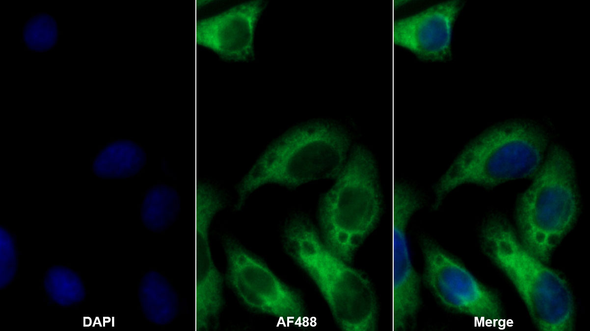 Monoclonal Antibody to Protein Kinase C Epsilon (PKCe)