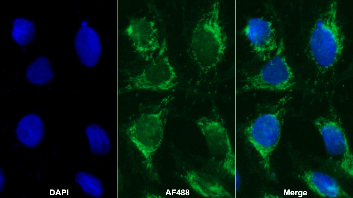 Monoclonal Antibody to Osteocalcin (OC)