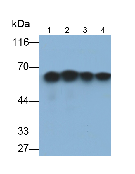 Monoclonal Antibody to Cytokeratin 5 (CK5)