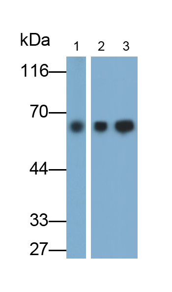 Monoclonal Antibody to Cytokeratin 5 (CK5)