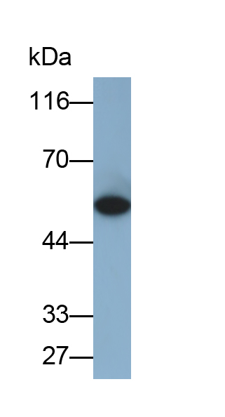 Monoclonal Antibody to Cytokeratin 5 (CK5)