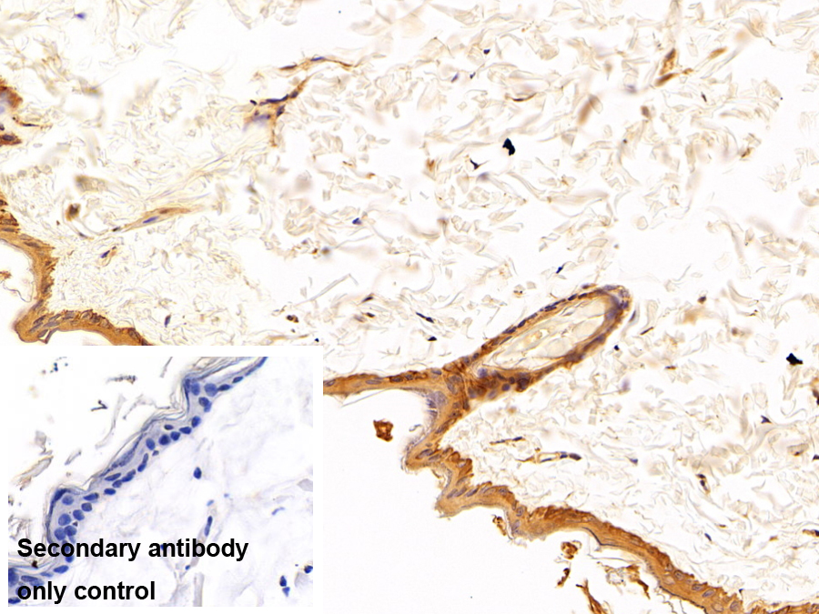 Monoclonal Antibody to Cytokeratin 5 (CK5)