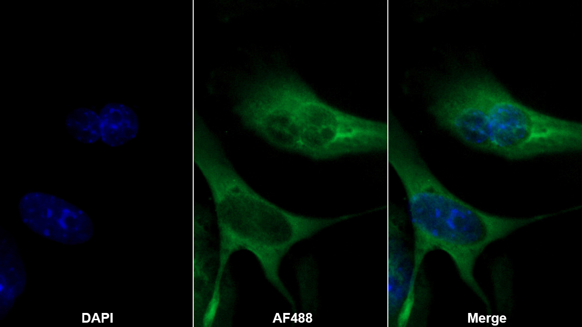 Monoclonal Antibody to Natriuretic Peptide Precursor B (NPPB)