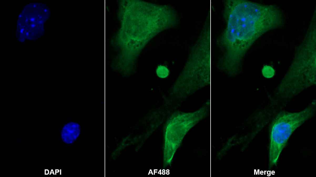 Monoclonal Antibody to Natriuretic Peptide Precursor B (NPPB)