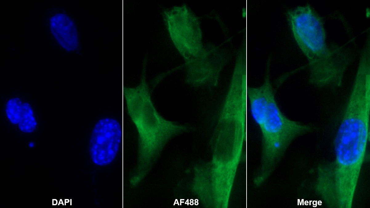 Monoclonal Antibody to Natriuretic Peptide Precursor B (NPPB)