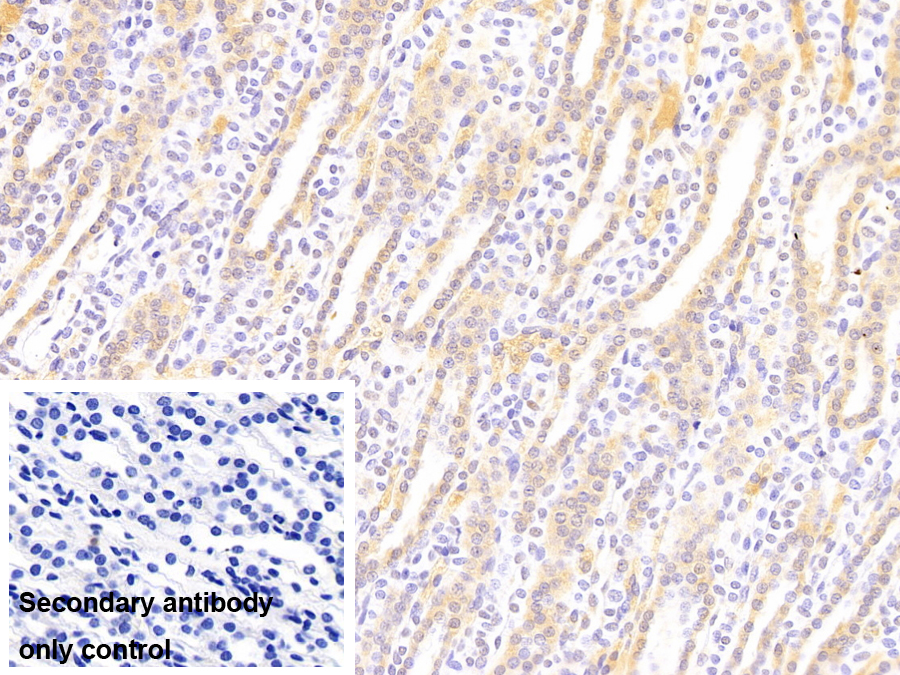 Monoclonal Antibody to Ataxin 1 (ATXN1)