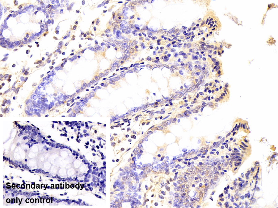 Monoclonal Antibody to Protein Kinase R (PKR)