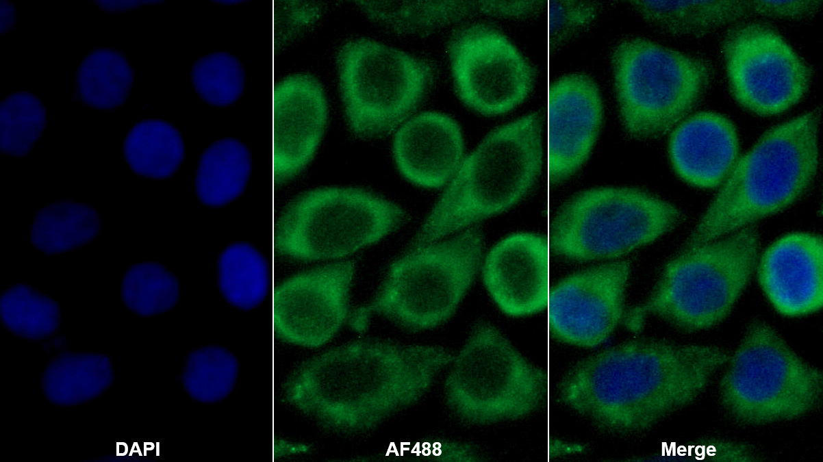 Monoclonal Antibody to Platelet Derived Growth Factor AA (PDGFAA)