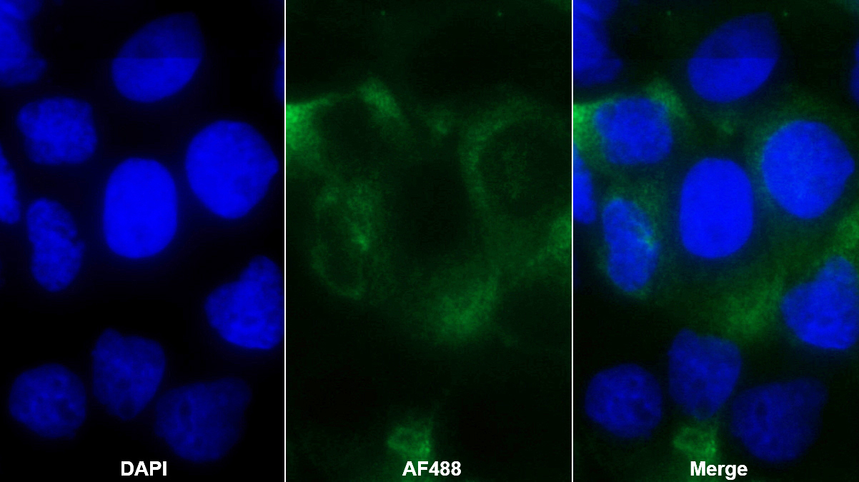 Monoclonal Antibody to Tissue Factor (TF)