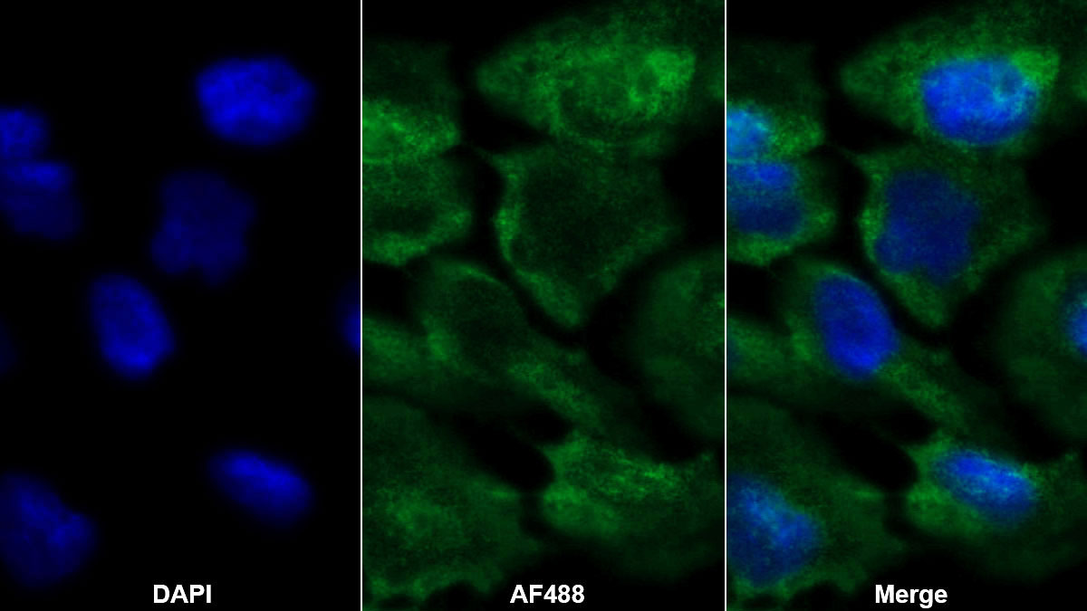 Monoclonal Antibody to Platelet Derived Growth Factor Subunit A (PDGFA)