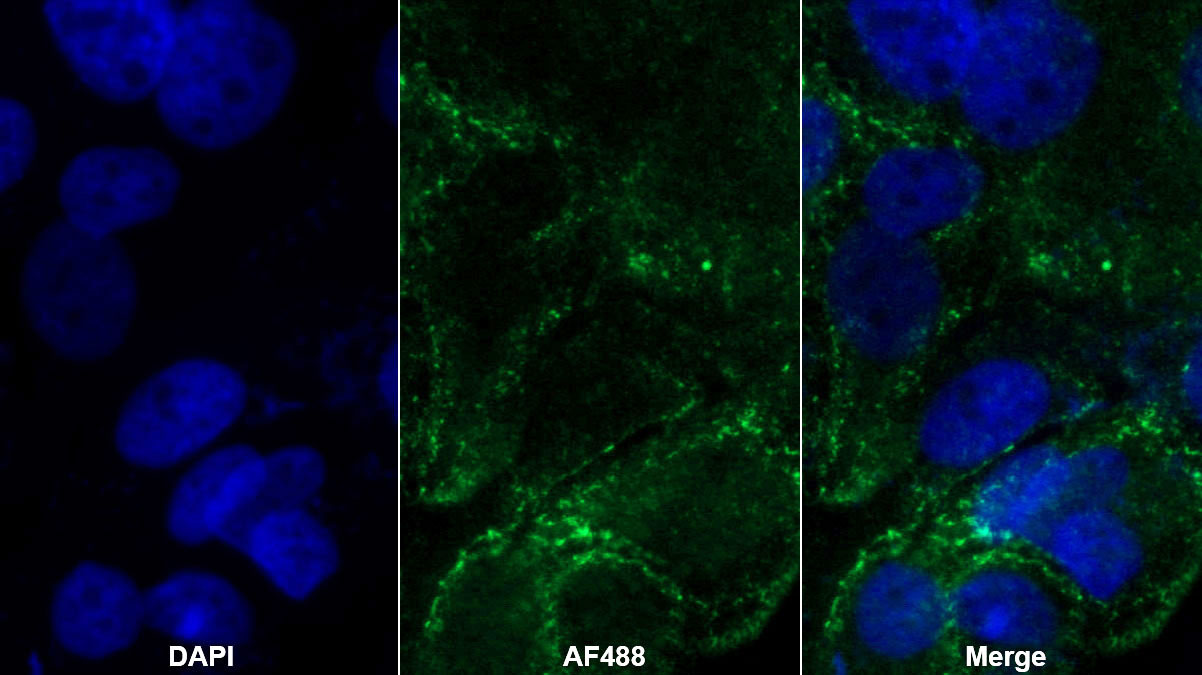 Monoclonal Antibody to Platelet Derived Growth Factor Subunit A (PDGFA)