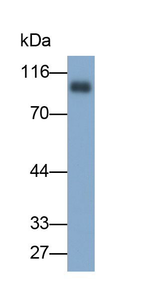 Monoclonal Antibody to Thrombomodulin (TM)