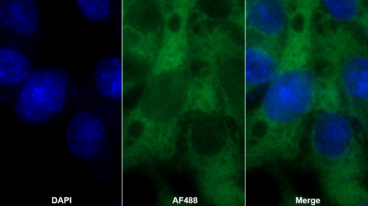 Monoclonal Antibody to Plasminogen Activator Inhibitor 2 (PAI2)